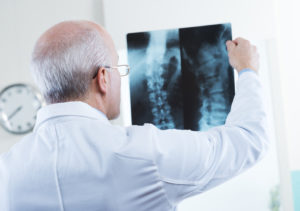 Male doctor looking at x-ray images of human spine.