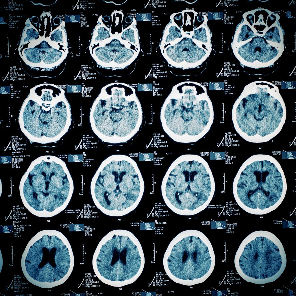 Pattern of human skull slices on MR imaging film.