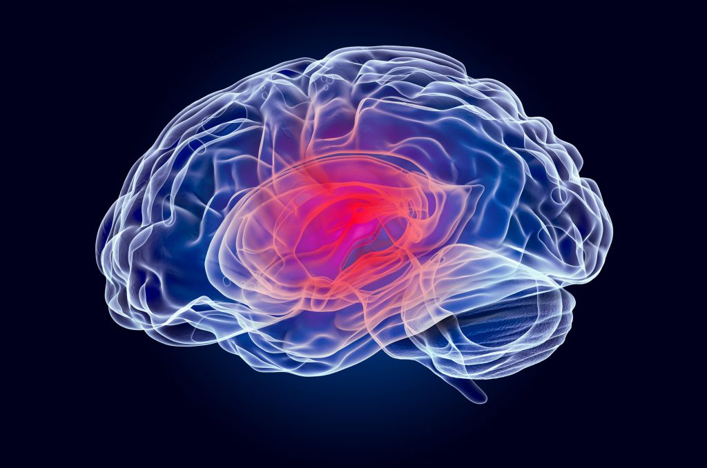3D rendering of a brain with a red heatmap point illustrating an injury.