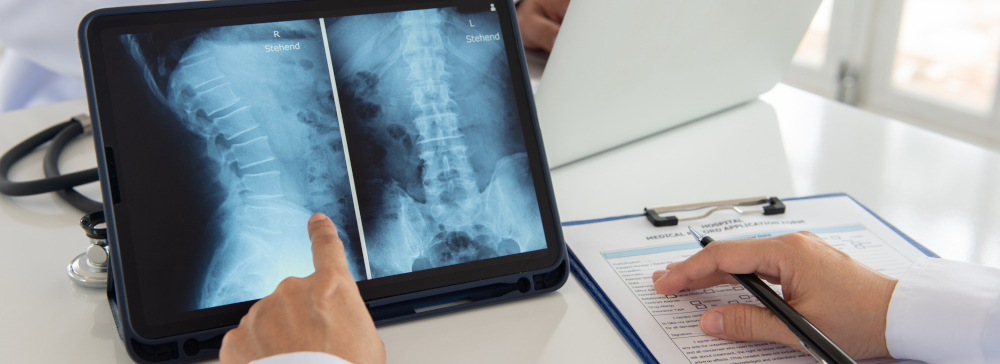 Doctor examining a spinal x-ray image on a digital tablet screen